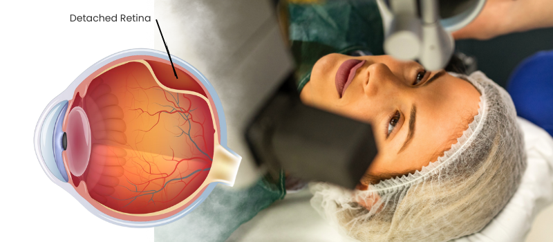 cornea and keratoconus treatment in chinchwad pune