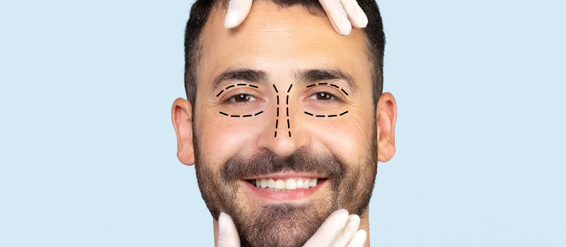 SMILE Eye Surgery