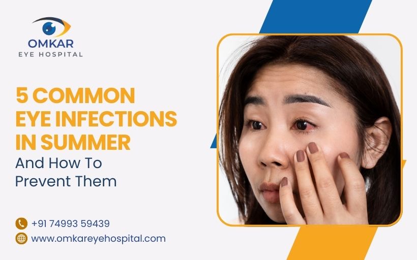 5 Common Eye Infections In Summer And How To Prevent Them