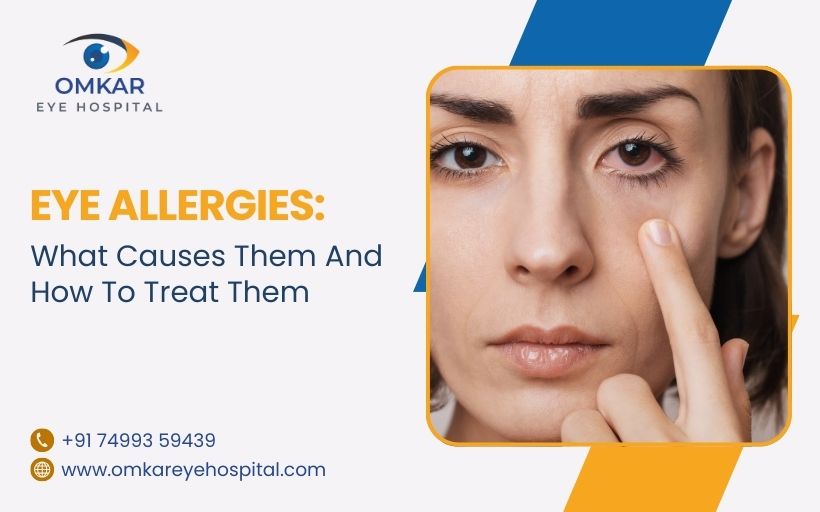 Eye Allergies What Causes Them And How To Treat Them