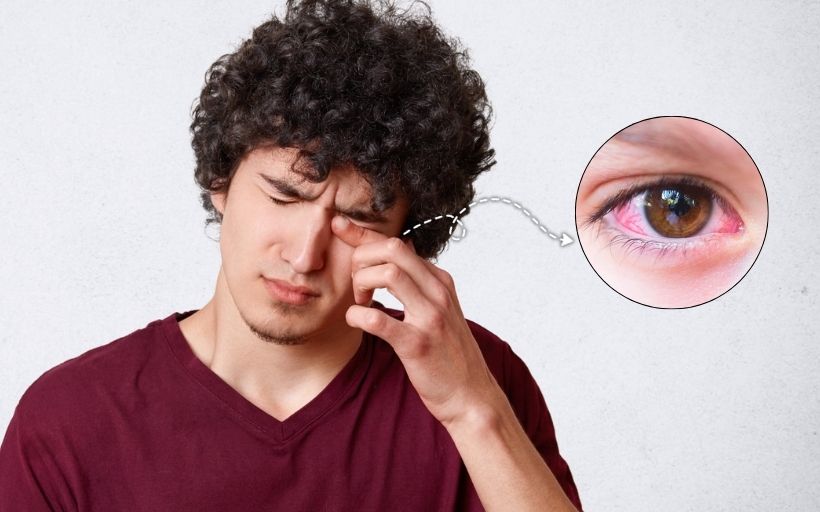 What is Conjunctivitis Symptoms Causes and Treatment Options